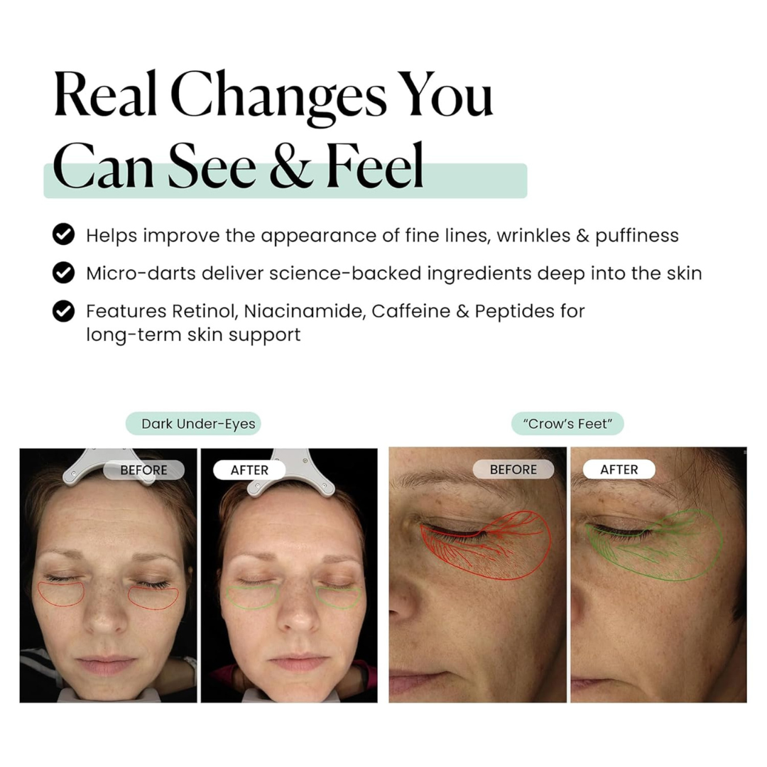 Sculptara™ Micro Infusion Eye Patches