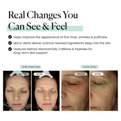 Sculptara™ Micro Infusion Eye Patches